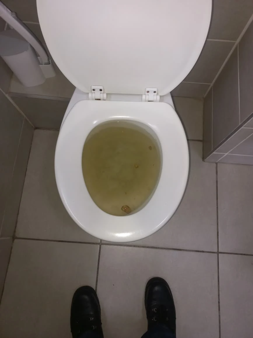 Blocked toilet with high dirty water level before overflowing toilet clearing.